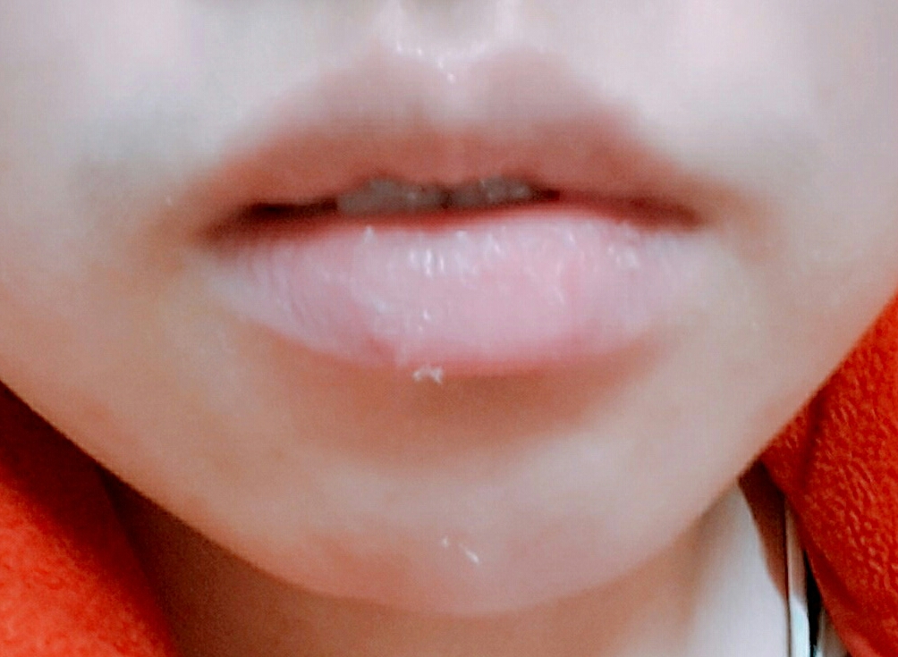 와 립밤 바르고 나중에 닦아내는 거 각질제거 대박이긴 하다 | 인스티즈