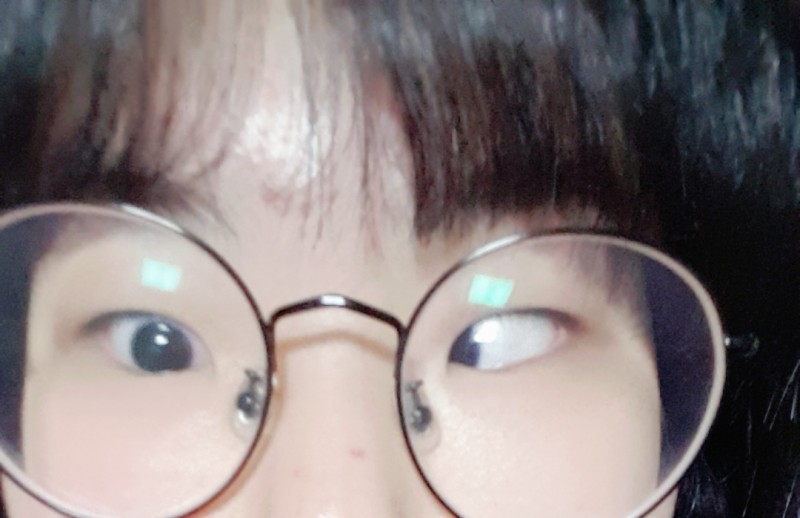 눈 이렇게 할수있는 사람40 | 인스티즈