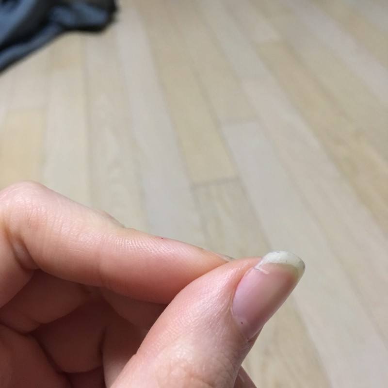 손톱 이렇게 갈라진?깨진?거 어떡해?ㅠㅠㅠㅠ | 인스티즈