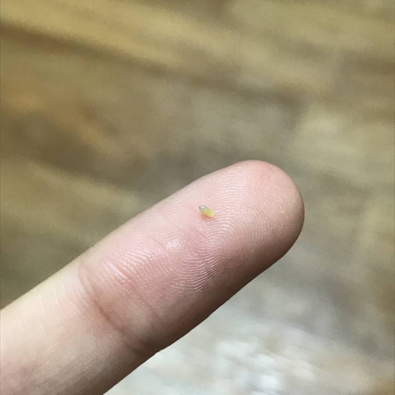 익이니들아 내 피지 봐줘 대박적 | 인스티즈