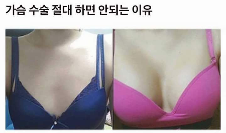 가슴성형 무섭다 하지마 | 인스티즈