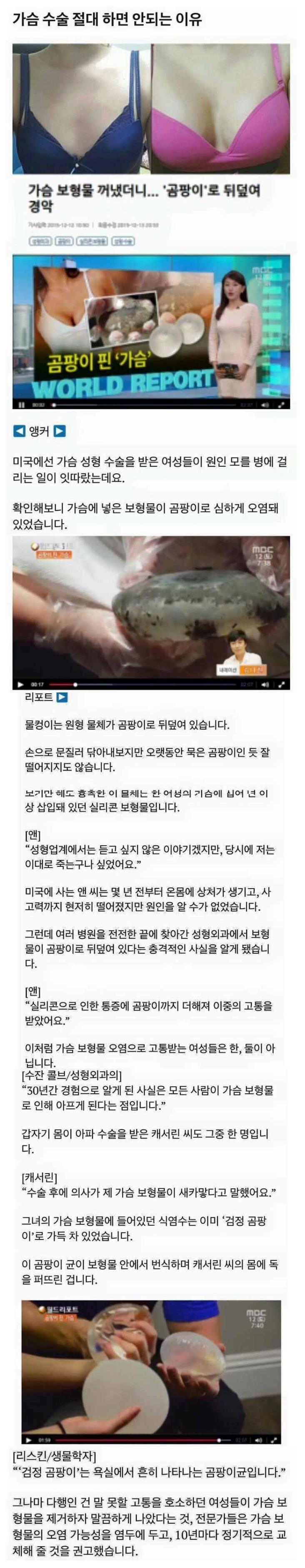 가슴 수술 절대 하면 안되는 이유.jpg | 인스티즈