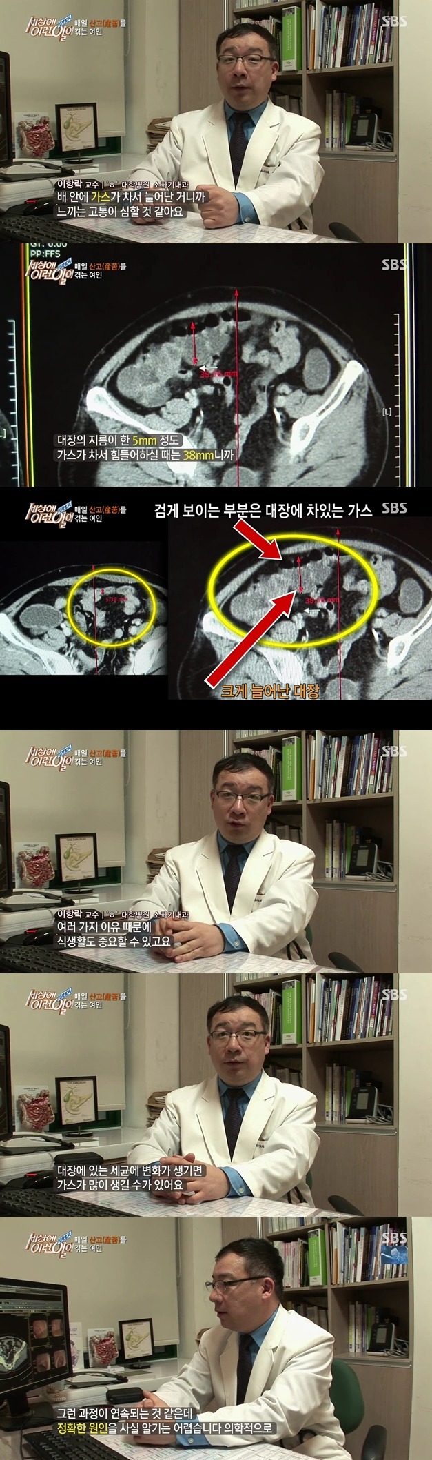 [세상에이런일이] 매일 출산의 고통을 겪는 여자.jpg | 인스티즈