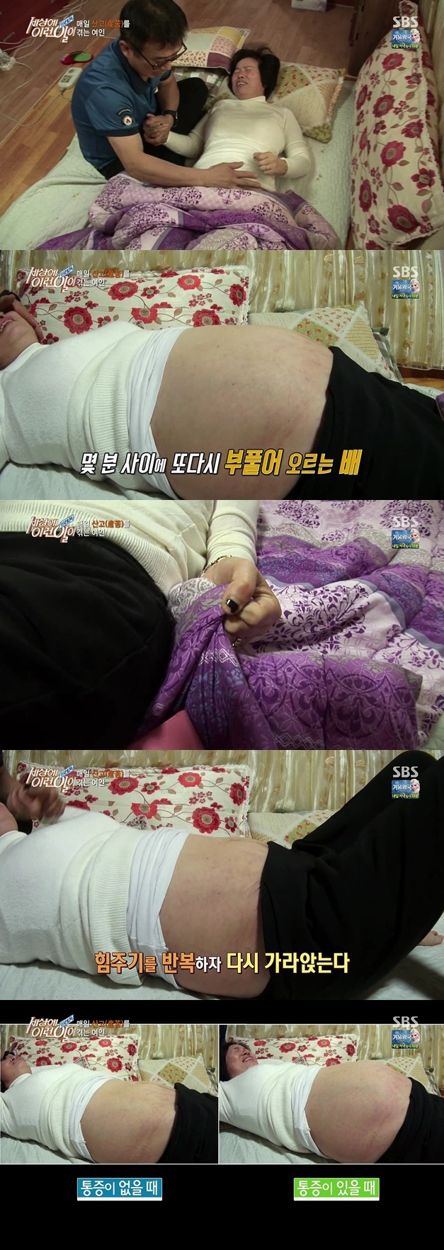 [세상에이런일이] 매일 출산의 고통을 겪는 여자.jpg | 인스티즈