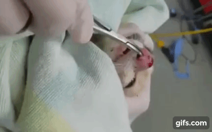 거대한 코딱지.gif (혐오주의) | 인스티즈