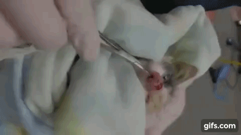 거대한 코딱지.gif (혐오주의) | 인스티즈