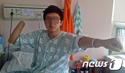 수류탄 폭발로 오른쪽 손목 나간 병사.jpg | 인스티즈