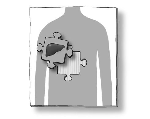 간이식 수술영상.avi | 인스티즈