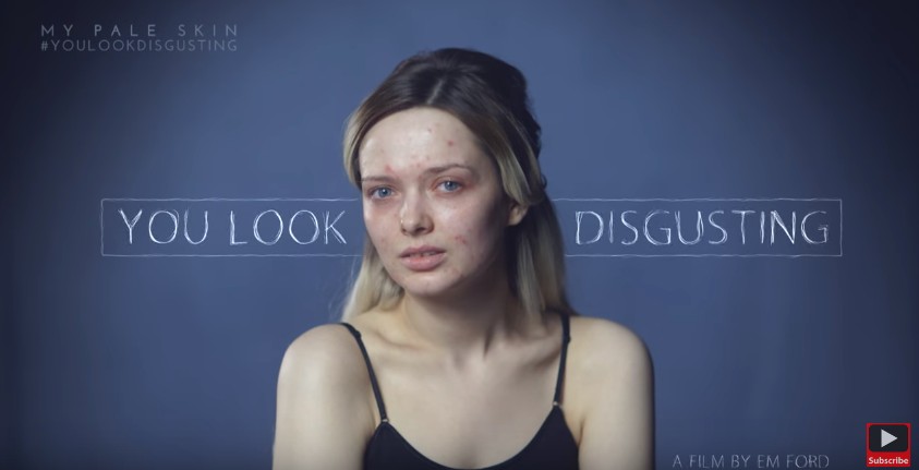 지금 해외에서 큰 반향을 불러일으키고 있는 영상 "넌 역겹게 생겼어" | 인스티즈