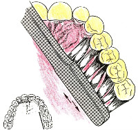 치과의사가 충치, 풍치가 거의 없는 비결 | 인스티즈