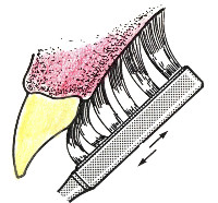 치과의사가 충치, 풍치가 거의 없는 비결 | 인스티즈
