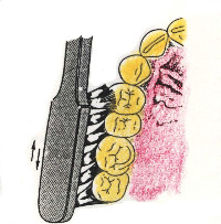 치과의사가 충치, 풍치가 거의 없는 비결 | 인스티즈