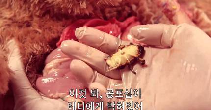 테디의 수술 | 인스티즈