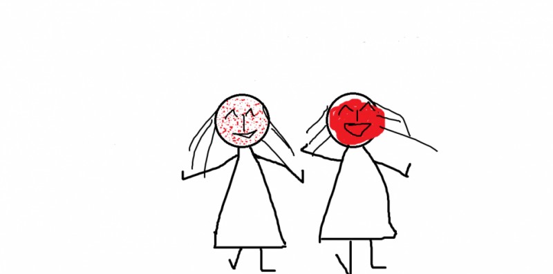 여드름 작게 여러개 생기기 VS 여드름 크게 한개 생기기 | 인스티즈