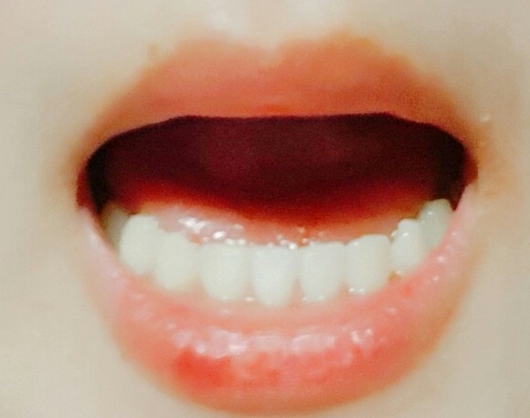 내 치아 완전 가지런하제 | 인스티즈